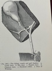 Antique 1900/1901 Two Volume Set Operative Surgery by Joseph D. Bryant, M.D.