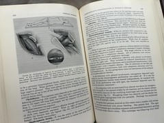 Medical Department: United States Army~ Surgery World War II: Thoracic Surgery