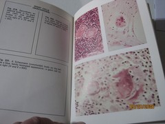 Vintage Color Atlas of General Pathology book G. Austin Gresham 1971