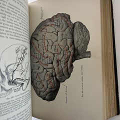 Antique Manual Of Operative Surgery by Joseph D. Bryant M.D. Vintage 1900 3rd Ed