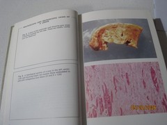 Vintage Color Atlas of General Pathology book G. Austin Gresham 1971