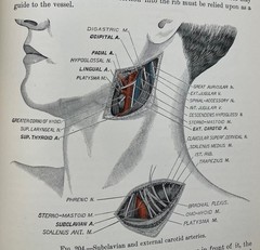 Antique 1900/1901 Two Volume Set Operative Surgery by Joseph D. Bryant, M.D.