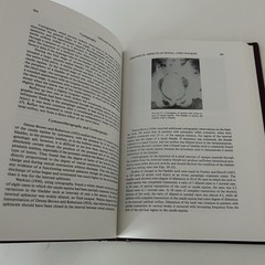 Medical Department US Army Surgery In World War II Urology Book 1987 Military