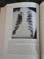The Practitioners Library of Medicine and Surgery 1938 Supplement Index