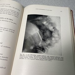 “Surgery of the Spinal Column” 1945 Albee Powers McDowell HC