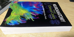Neuroanatomy through Clinical Cases – Paperback, by Blumenfeld Hal – Good