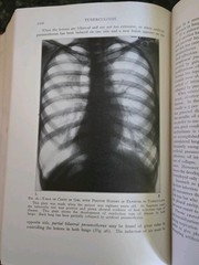 The Practitioners Library of Medicine and Surgery 1935 Pediatrics