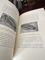 1990 The Classics of Surgery Library- DUODENAL ULCER By B. G. A . Moynihan