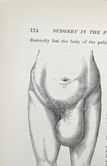 Vintage 1880 Book Surgery In The Pennsylvania Hospital by Thomas Morton * Good