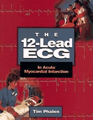 The 12-Lead ECG: In Acute Myocardial Infarction – paperback Phalen, Tim