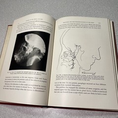 “Surgery of the Spinal Column” 1945 Albee Powers McDowell HC