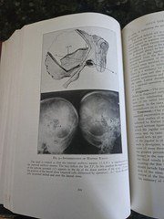The Practitioners Library of Medicine and Surgery 1937 Eye, Ear, Nose, & Throat