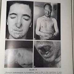 Practical Dermatology by George M. Lewis M.D. (Hardcover 1955)