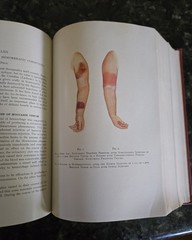 The Practitioners Library of Medicine and Surgery 1938 Supplement Index