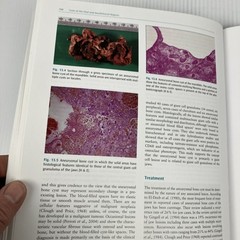 Cysts of the Oral and Maxillofacial Regions by Shear and Speight HC