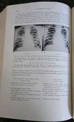 The Practitioners Library of Medicine and Surgery 1935 Pediatrics