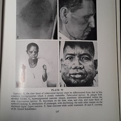Practical Dermatology by George M. Lewis M.D. (Hardcover 1955)