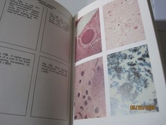Vintage Color Atlas of General Pathology book G. Austin Gresham 1971
