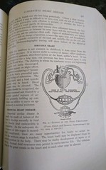 The Practitioners Library of Medicine and Surgery 1935 Pediatrics
