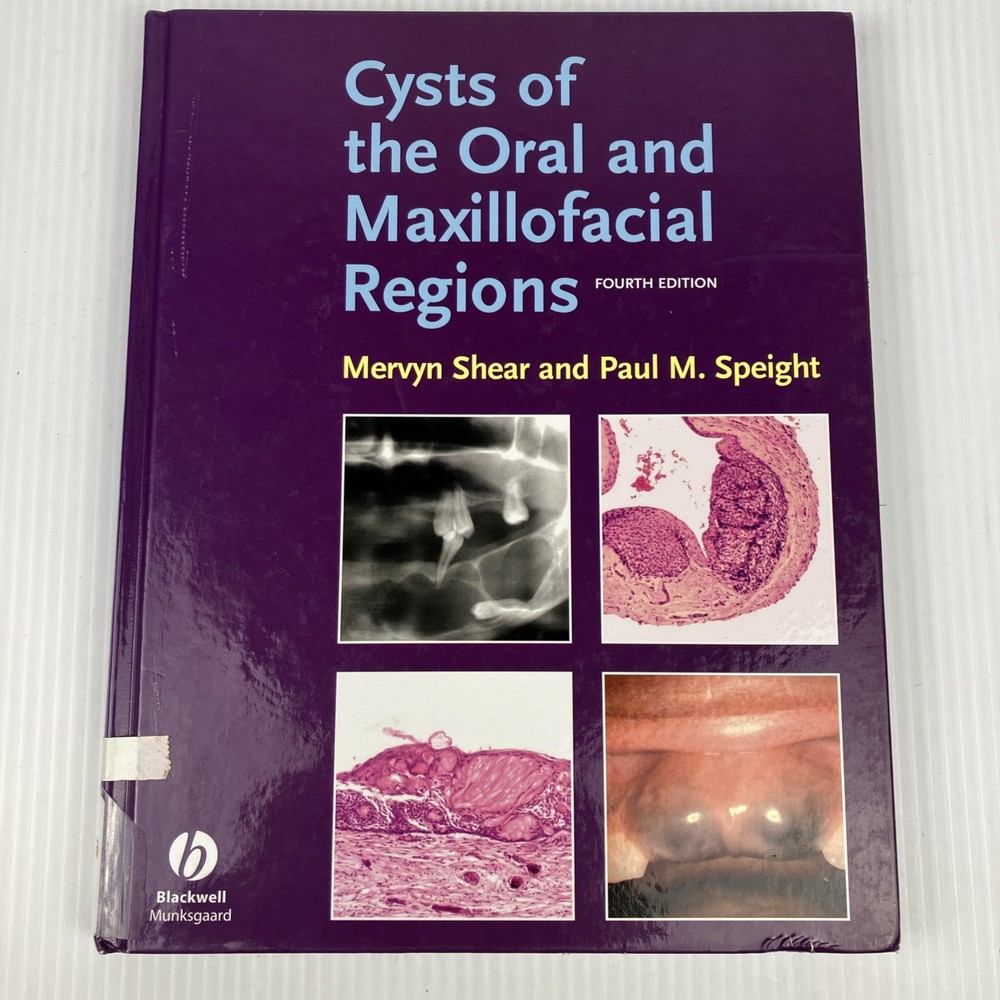 Cysts of the Oral and Maxillofacial Regions by Shear and Speight HC