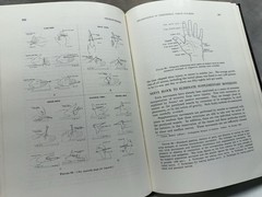 Medical Department: United States Army~ Surgery In World War II: Neurosurgery
