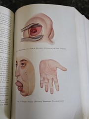 The Practitioners Library of Medicine and Surgery 1938 Supplement Index
