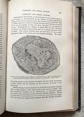 Antique, Principles Of Surgery, Nicholas Senn, 1891, 1st. Ed., Illustrated