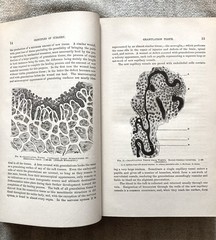 Antique, Principles Of Surgery, Nicholas Senn, 1891, 1st. Ed., Illustrated