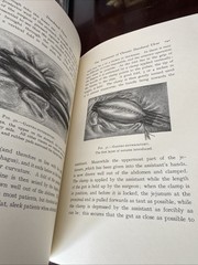 1990 The Classics of Surgery Library- DUODENAL ULCER By B. G. A . Moynihan