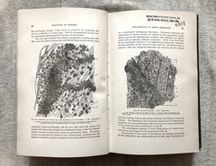 Antique, Principles Of Surgery, Nicholas Senn, 1891, 1st. Ed., Illustrated
