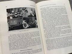 Medical Department: United States Army~ Surgery In World War II: Neurosurgery