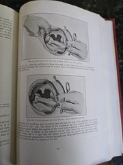 The Practitioners Library of Medicine and Surgery 1937 Eye, Ear, Nose, & Throat
