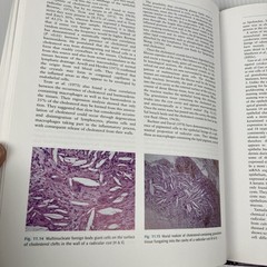 Cysts of the Oral and Maxillofacial Regions by Shear and Speight HC