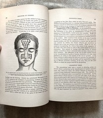 Antique, Principles Of Surgery, Nicholas Senn, 1891, 1st. Ed., Illustrated
