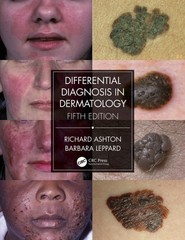 Differential Diagnosis in Dermatology – Ashton, Richard,Leppard, Barbara